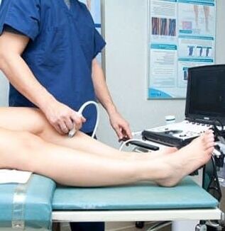 Ultrasound diagnosis of varicose veins. 